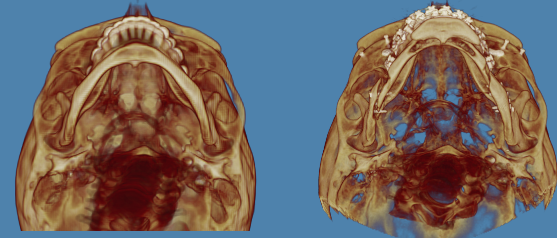 Ct scan compare below view