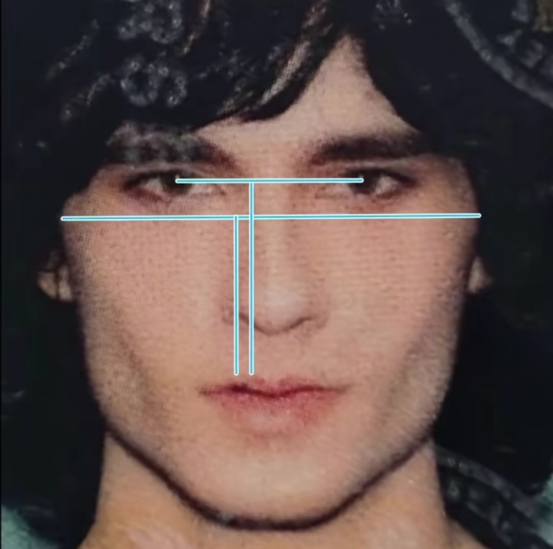 1000257499