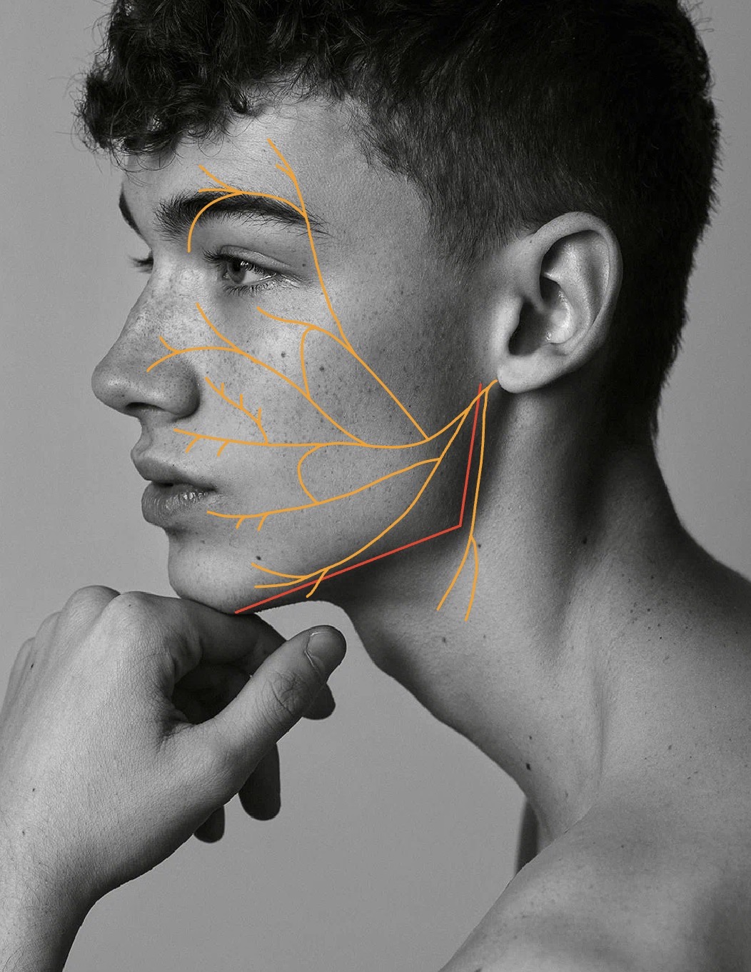 FacialNerves