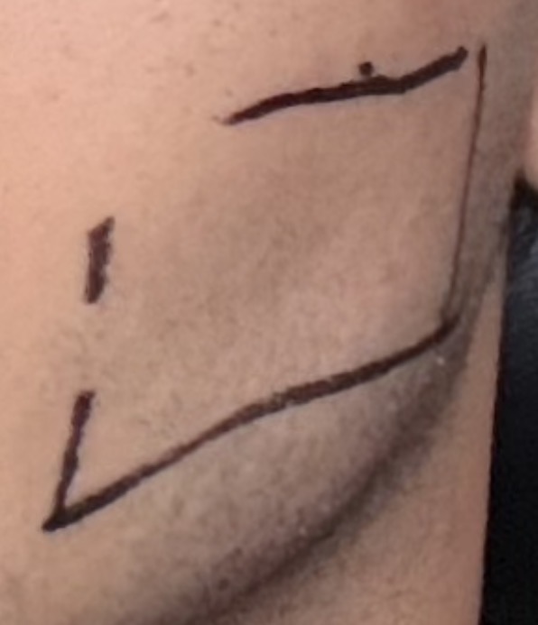 LipovelaGridNoPoints