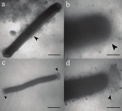 Electron microscopic images of Lactobacillus acidophilus ATCC 4356 a b Lactobacillusppm