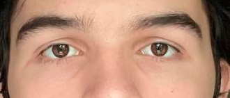 Eyes