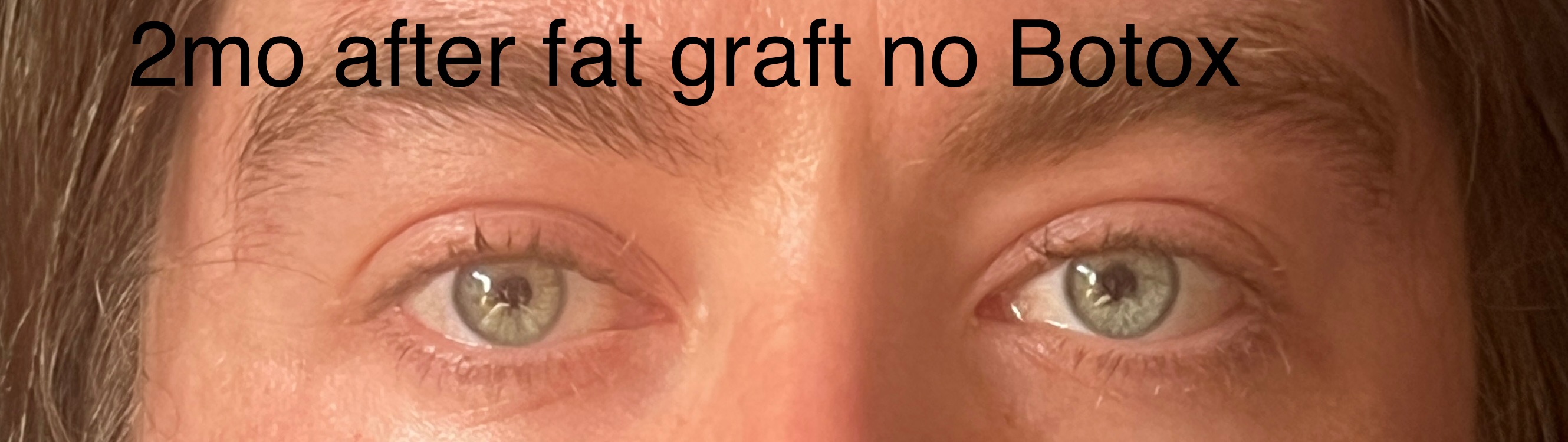 IMG 0727