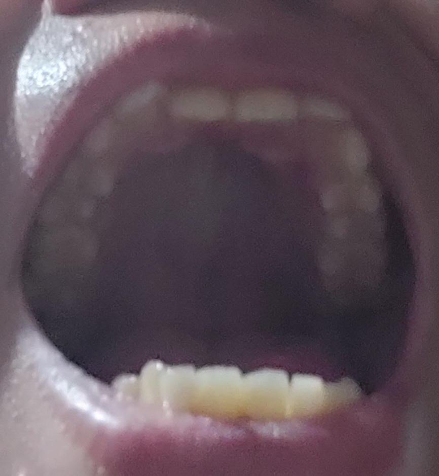 20260725 182801
