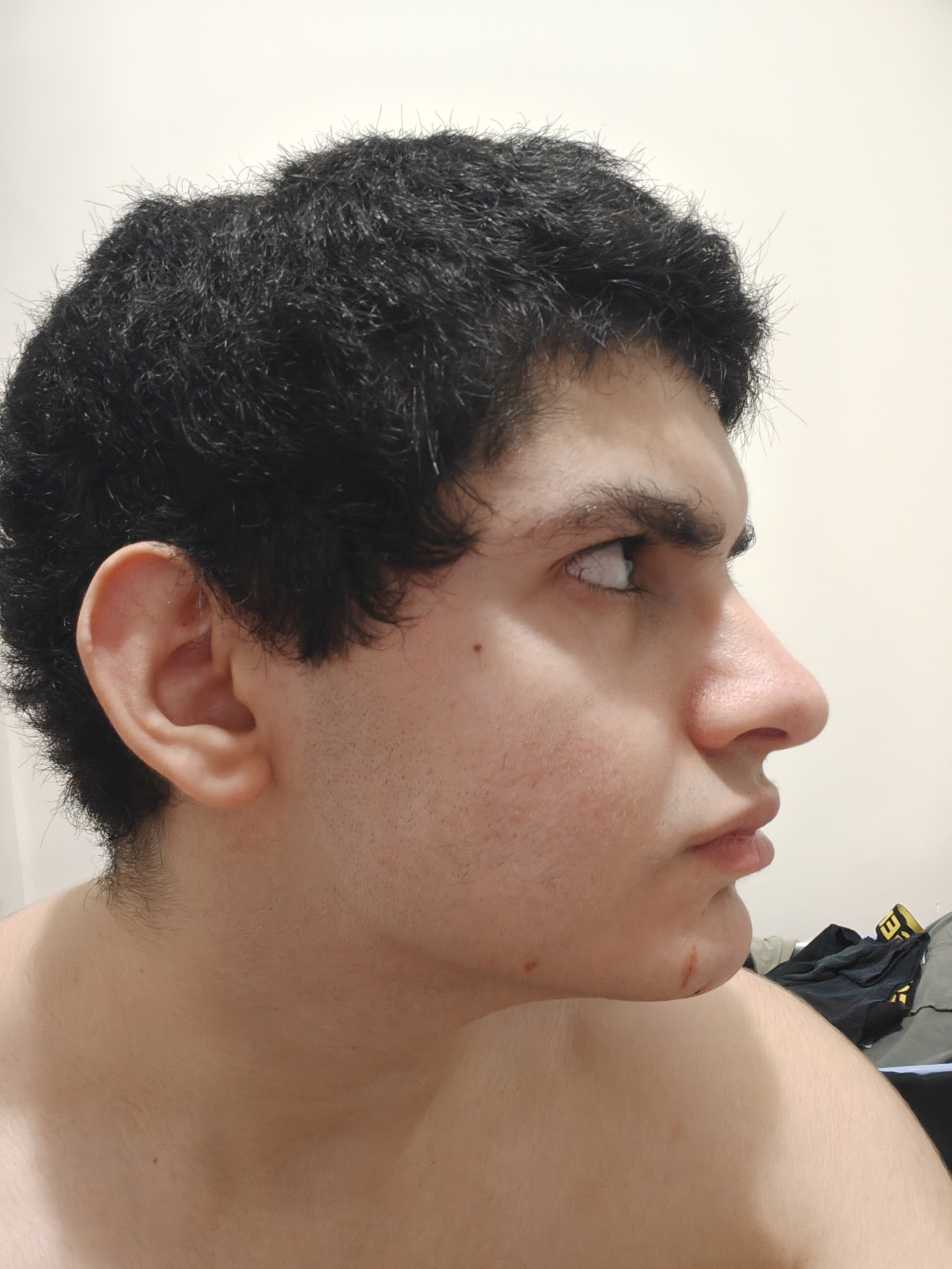 1000008670