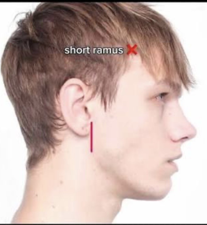 IMG 2123