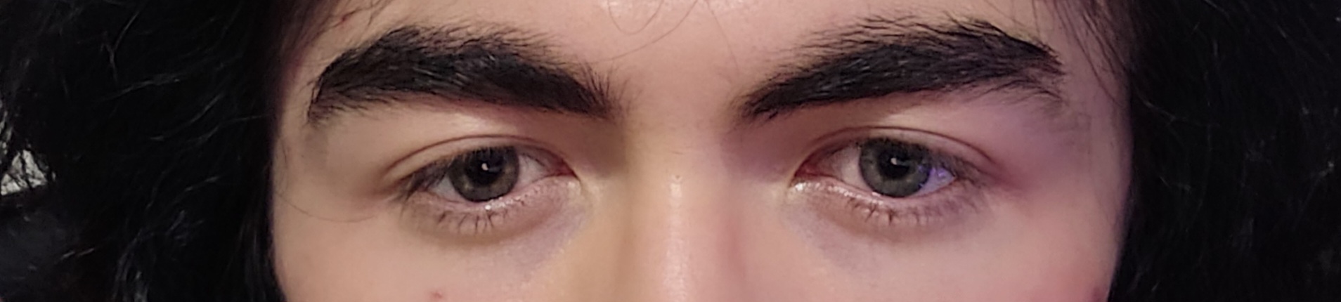 Sub 3 eye area
