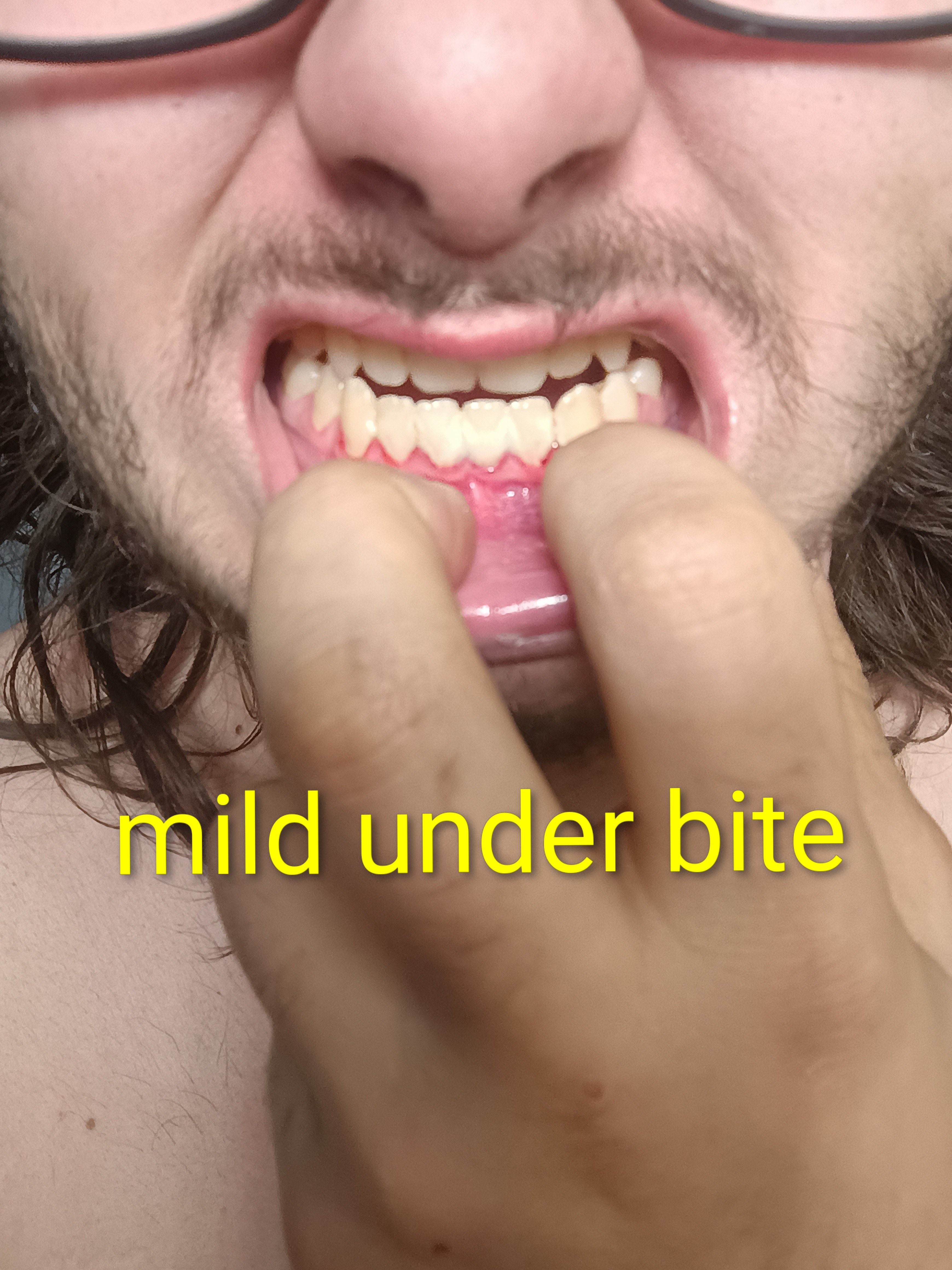 1000002838