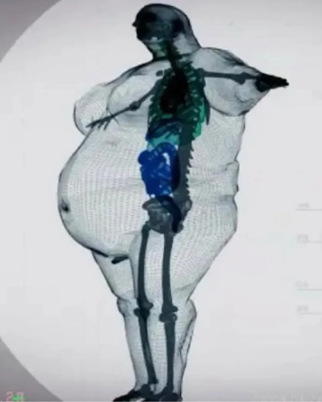 11825