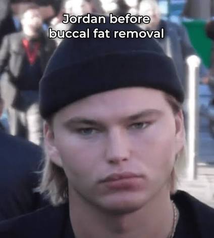 1785173175825
