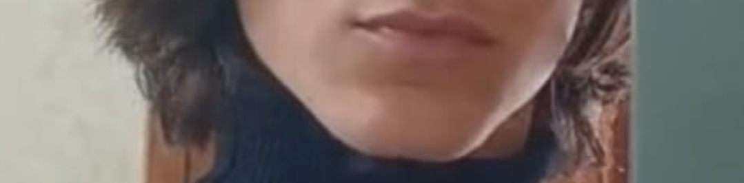 1000127856