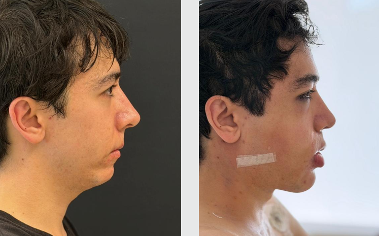 Profile progress 0
