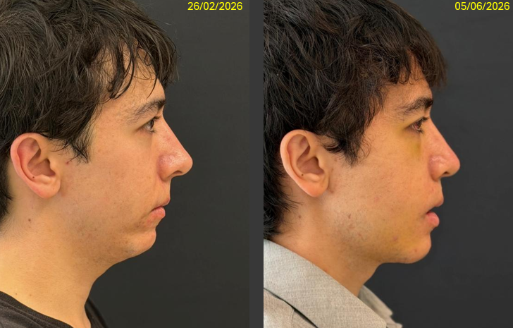 Profile progress 1