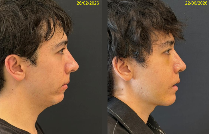 Profile progress 2