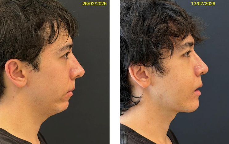 Profile progress 3