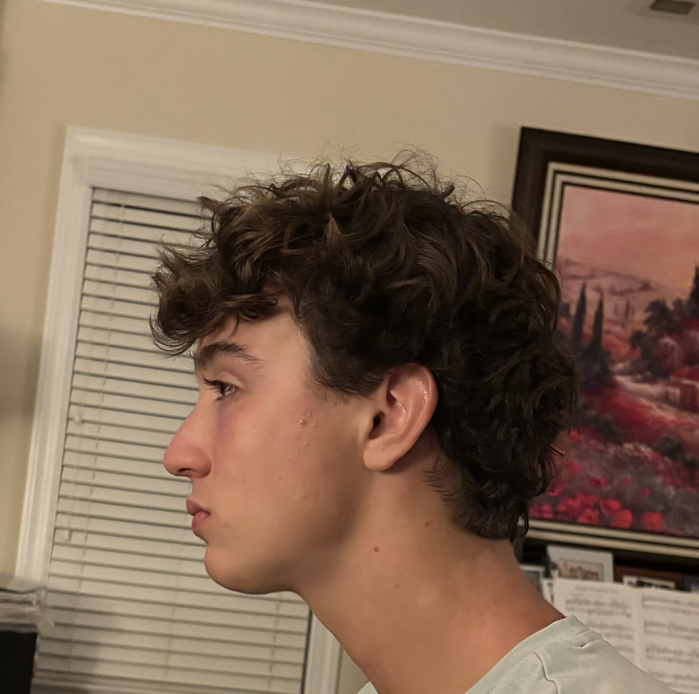 IMG 1739