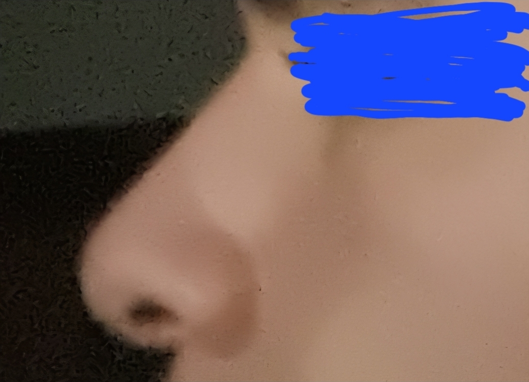 1000012397