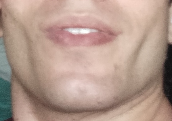 1000152079