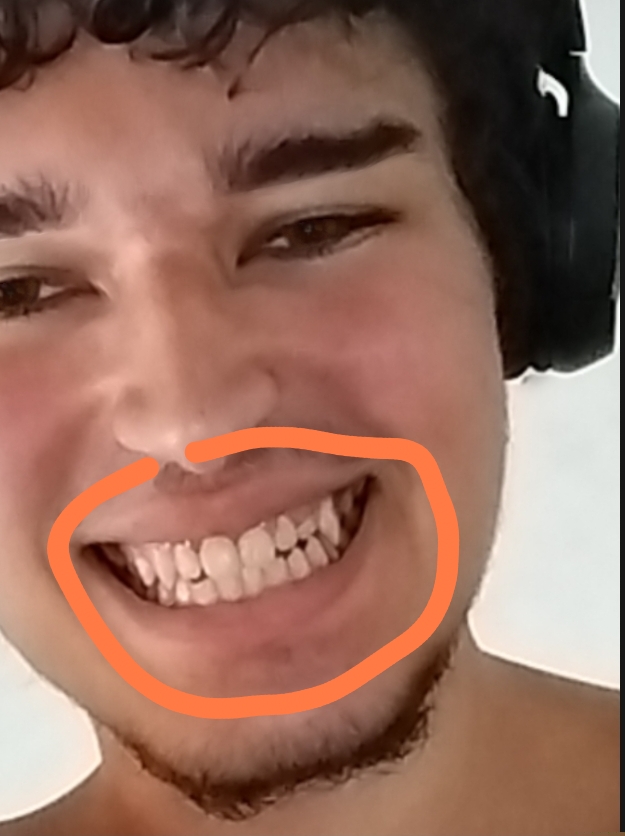 1000015282