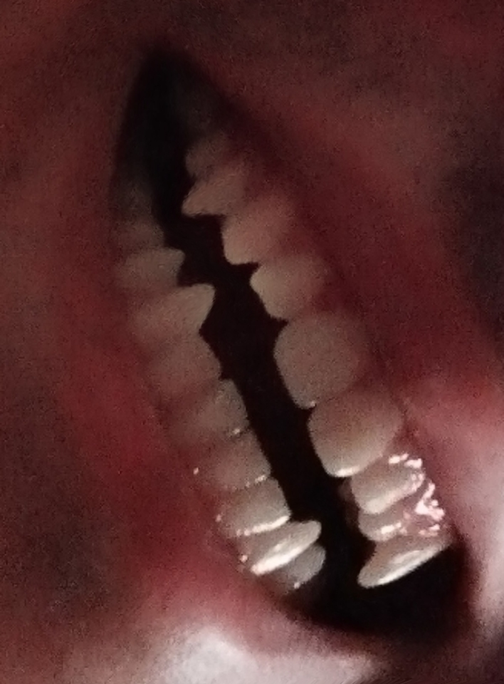 1000015257