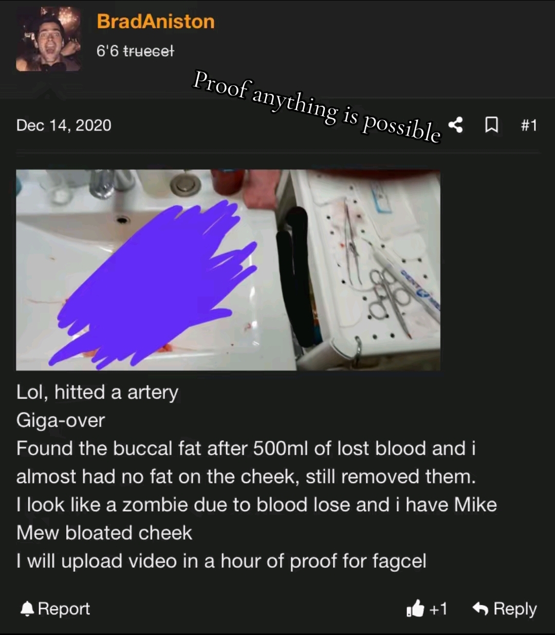 1000032339