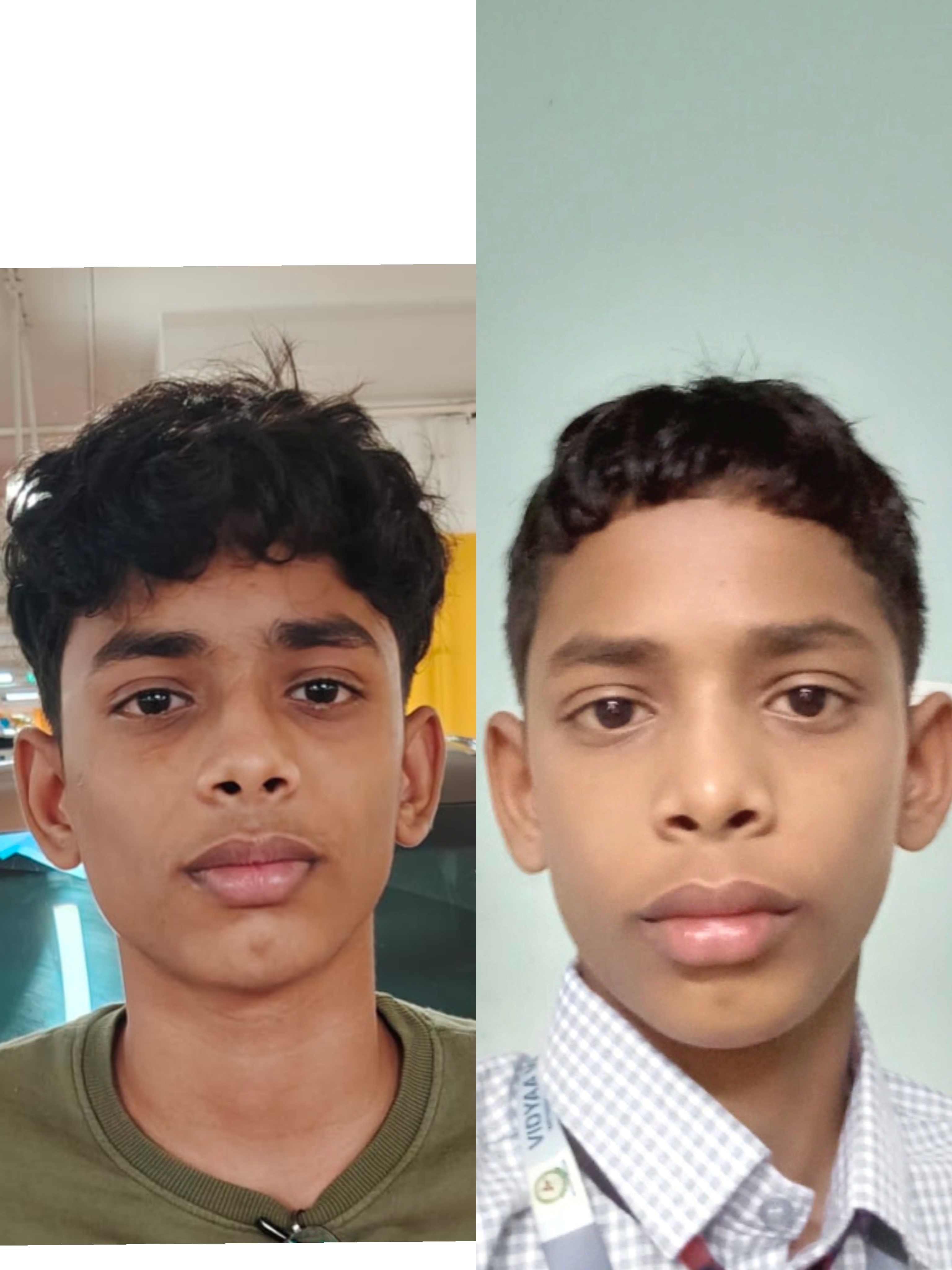 1000017035