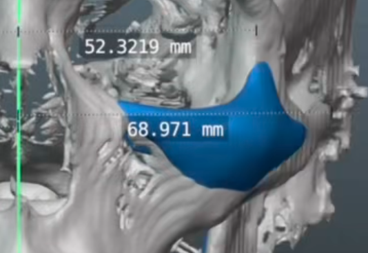 1785500420312
