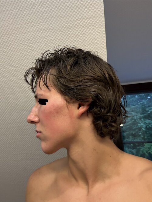 IMG 0832
