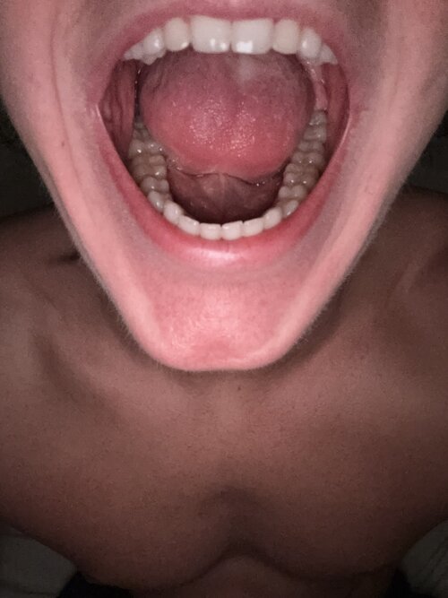IMG 0964