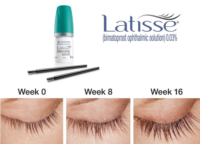 2_Latisse.jpg
