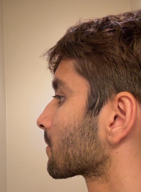 Side2.jpg