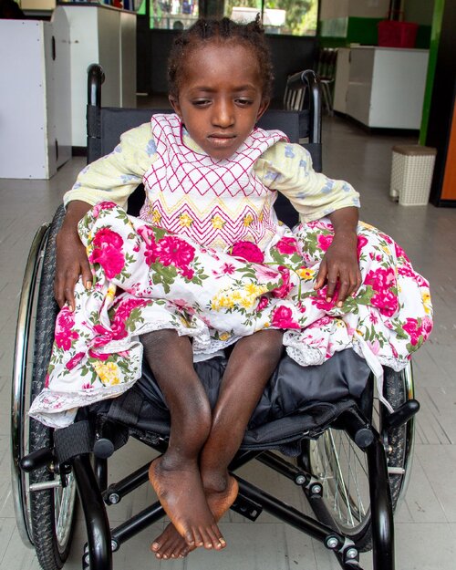 21012-ethiopia_dore-_et42342_preop1.jpeg