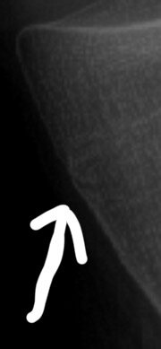 IMG_1052.jpeg