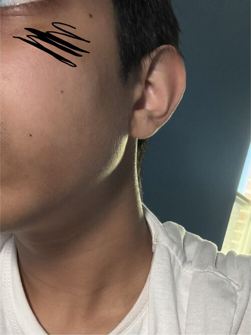 IMG 0282