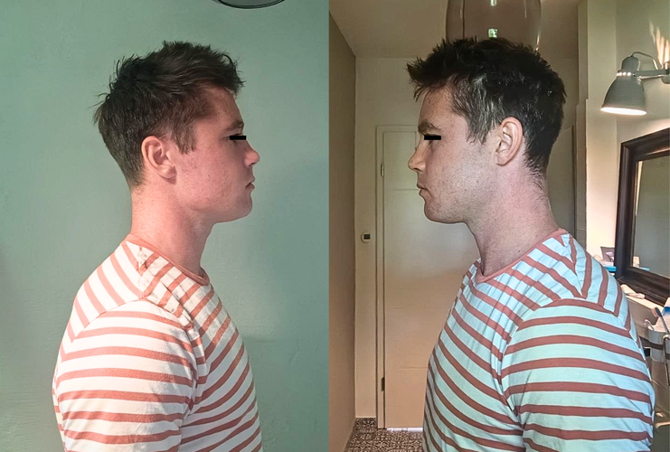 Shaven.png