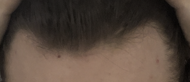 IMG_2034.png