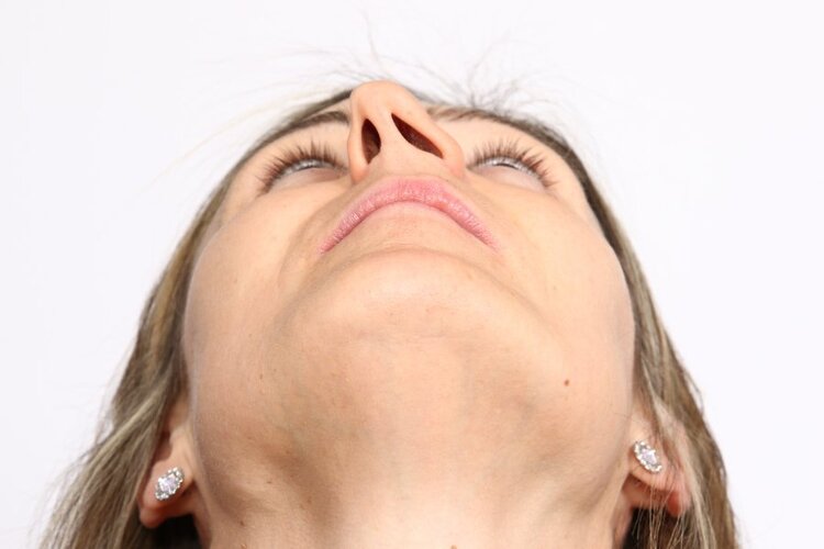 Deviated-Septum-Page-Image.jpg