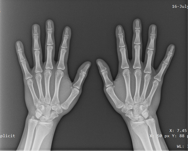 xray.png