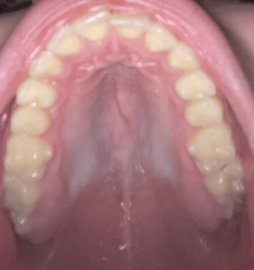 IMG 1129