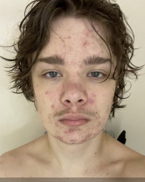 IMG 0196