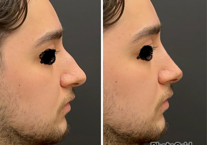 jn.png