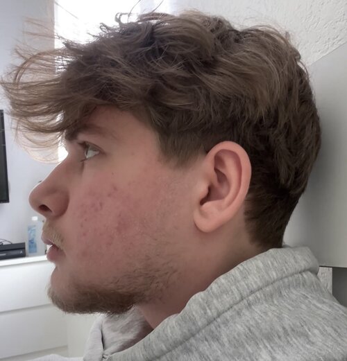 IMG 1341