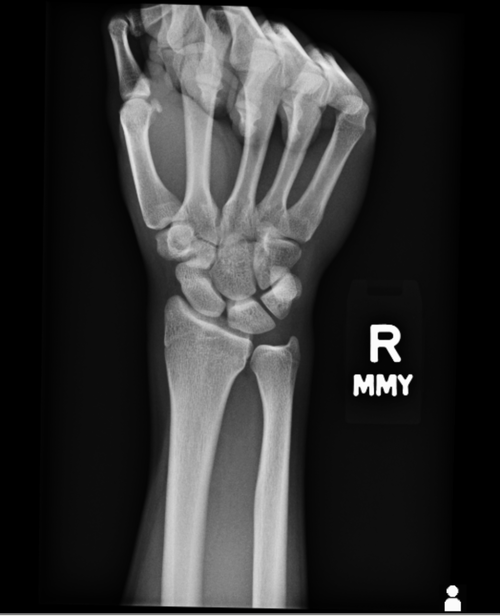 wrist1.png