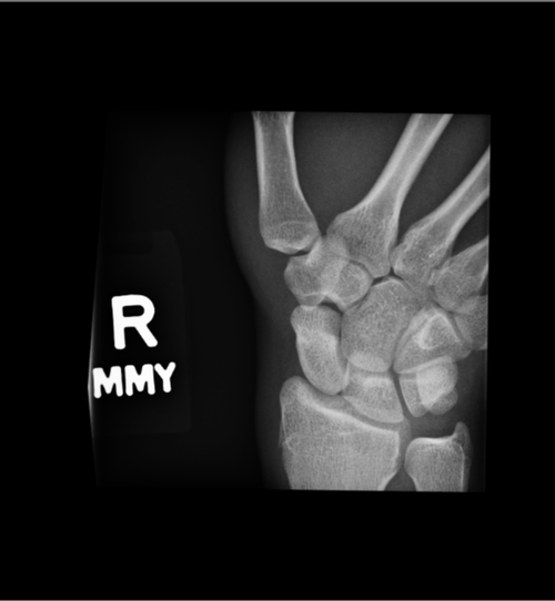 wrist4.png