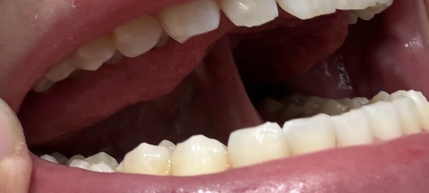 IMG_9398.jpeg
