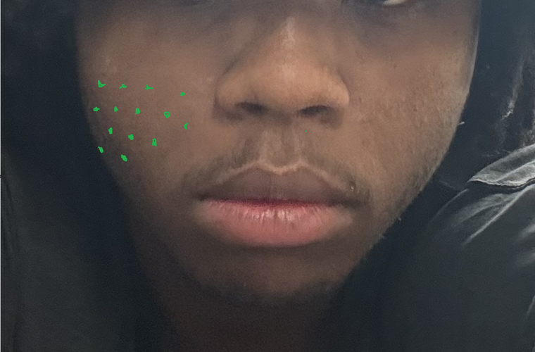 Front Grid spots.png