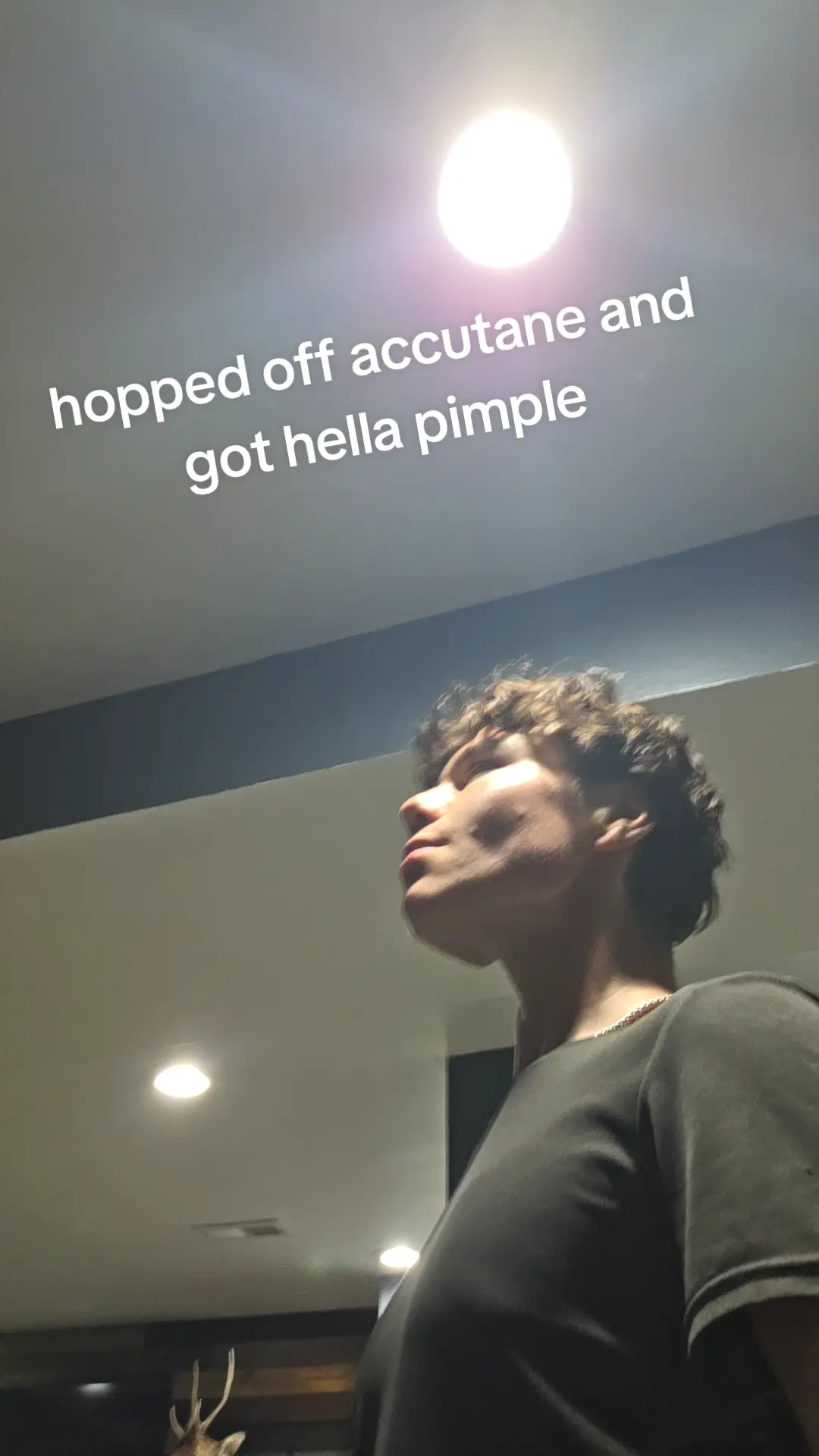 28867
