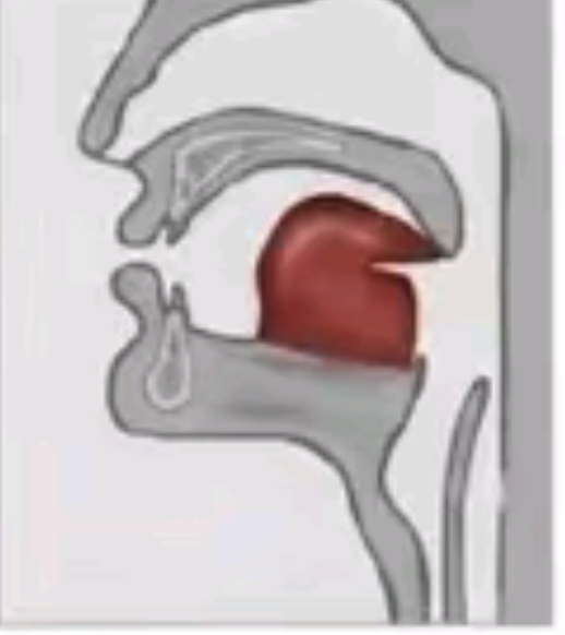 29035