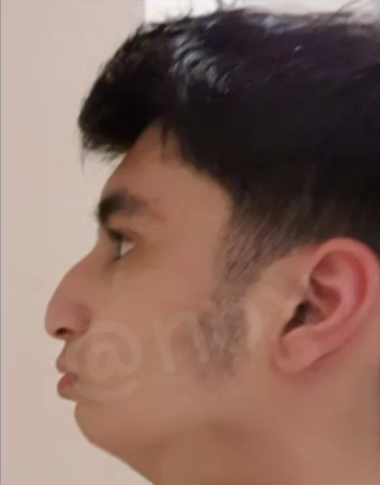 Screenshot 2026 08 02 19 10 57 641 comandroidchrome edit