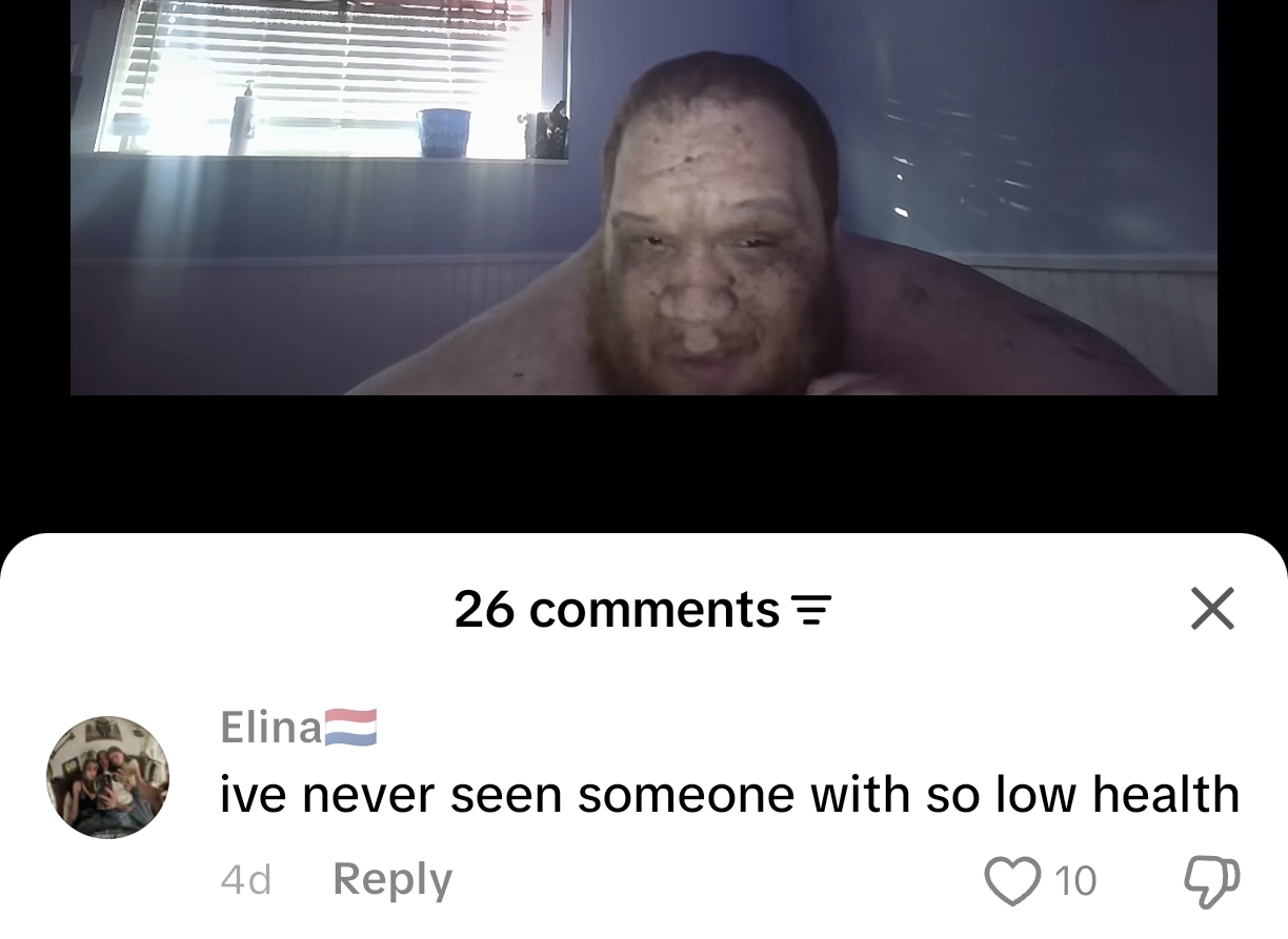 1000012614